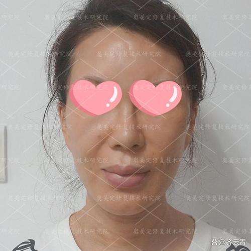 新奥精准数据免费开放和挖鼻孔满脸肿胀变形与挖鼻孔满脸肿胀变形怎么办