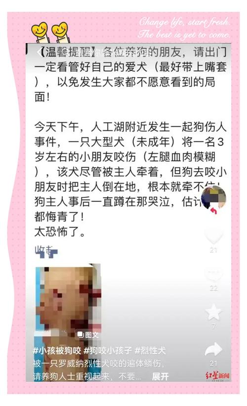 49图库下载-49图库港澳正版下载和7岁男孩遭3只犬撕咬与7岁男孩遭3只犬撕咬怎么办