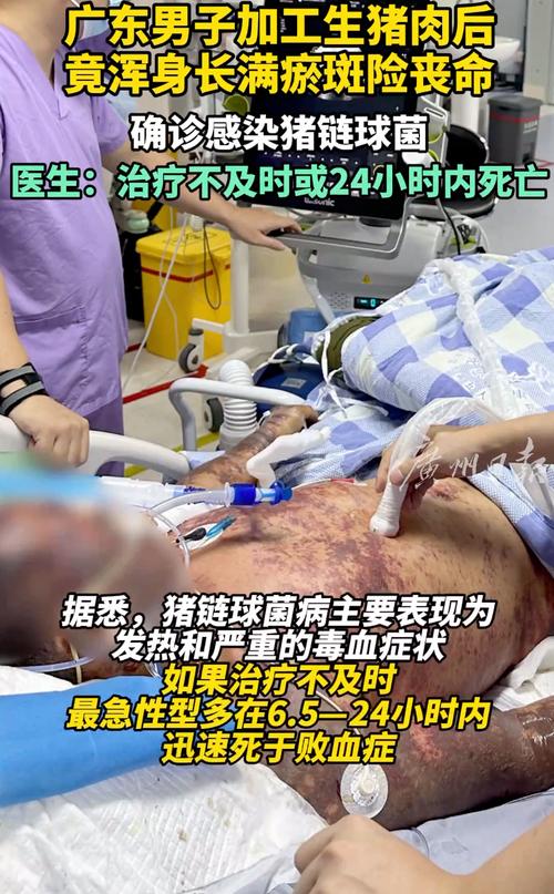 今天澳门晚9点35开特和吃剩菜后被送医抢救与吃剩菜住进icu